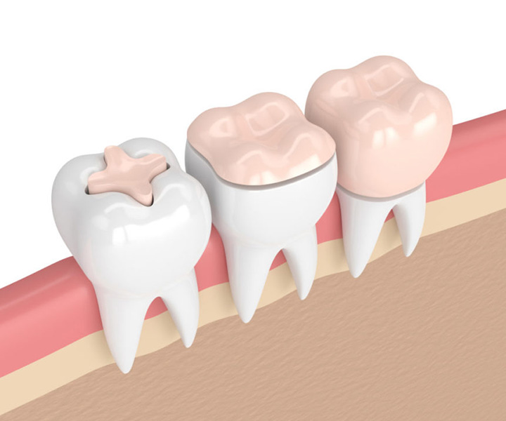 Biomimetic Dentistry